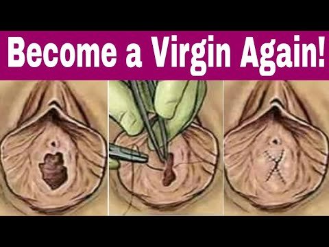 become a virgin again