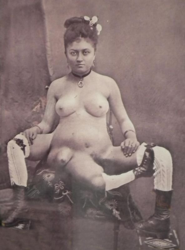 This French prostitute had 3 legs, 4 breast and 2 vaginas