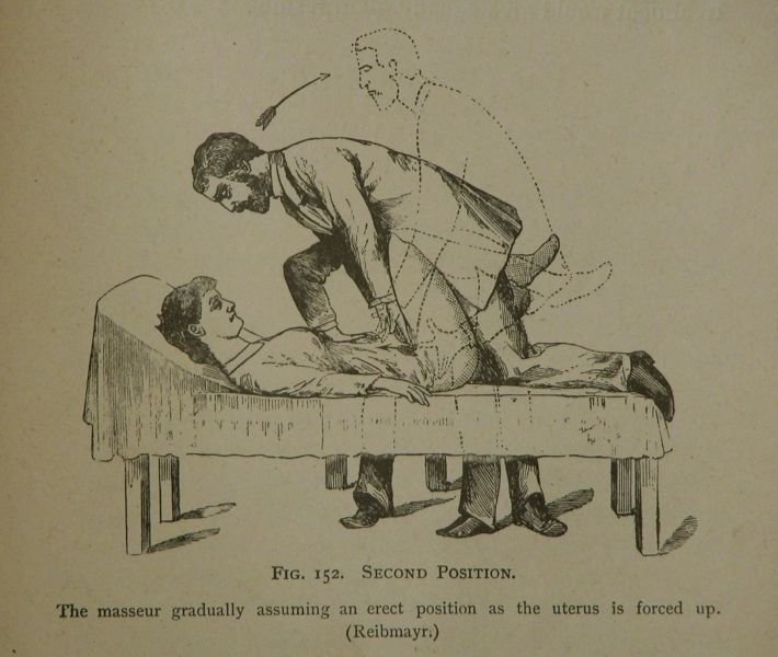 pelvic massage by Doctor