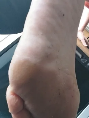 Foot
