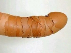eggs