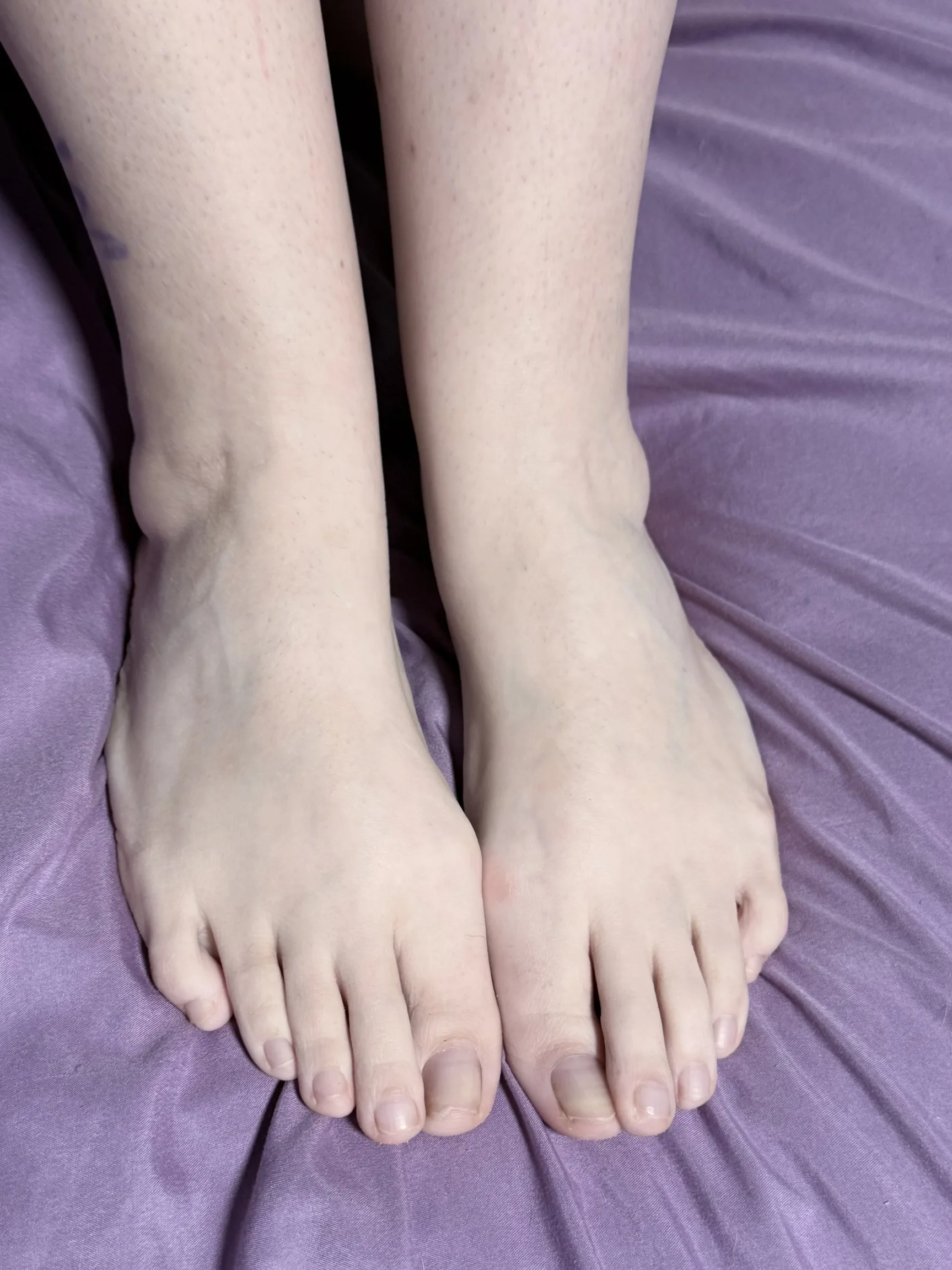 I can’t decide if I love my toes or feet more