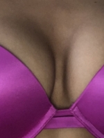 ttm1800690