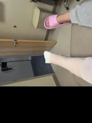 Fractured ankle  cover image