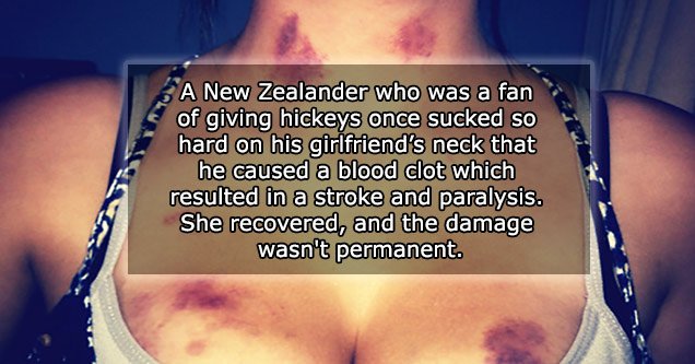 Bites Bruises and Hickies
