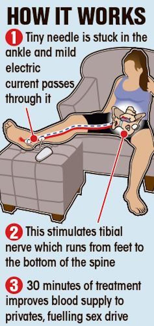 What is Ankle Zapping?