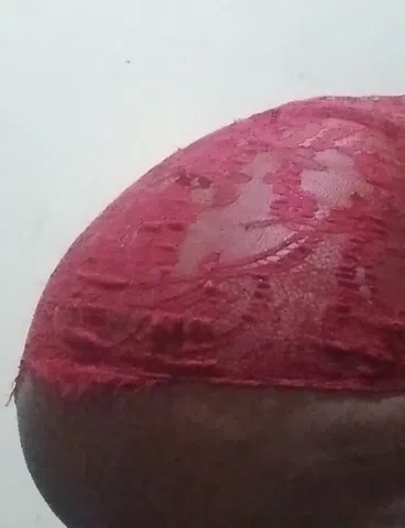 ttm3887984