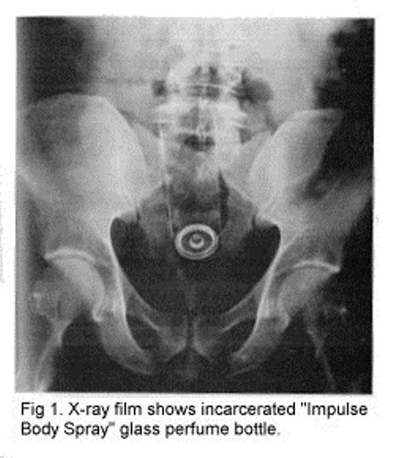 perfume bottle xray up butt